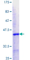 SDS-PAGE - Recombinant Human IKZF5 protein (AB163827)