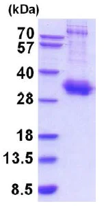 SDS-PAGE - Recombinant Human IL-10RA protein (His tag) (AB201890)