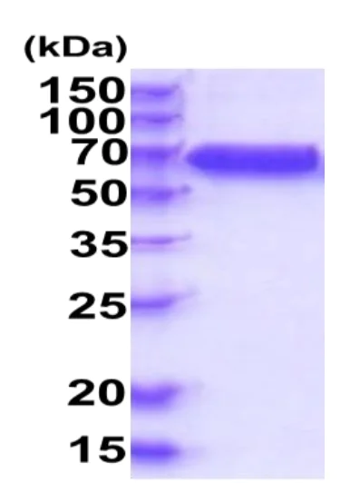 SDS-PAGE - Recombinant Human IL-10RB/IL-10R2 protein (Fc Chimera His Tag) (AB227419)