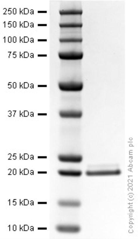 SDS-PAGE - Recombinant human IL-11 protein (Active) (AB281801), expandable thumbnail