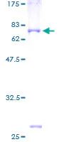SDS-PAGE - Recombinant Human IL-11RA protein (GST tag N-Terminus) (AB132575)