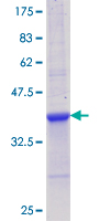 Recombinant Human IL-12 p35 protein