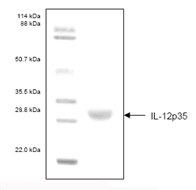 SDS-PAGE - Recombinant Human IL-12 p35 protein (AB53503)