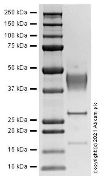 SDS-PAGE - Recombinant Human IL-12 p40 protein (AB287933)