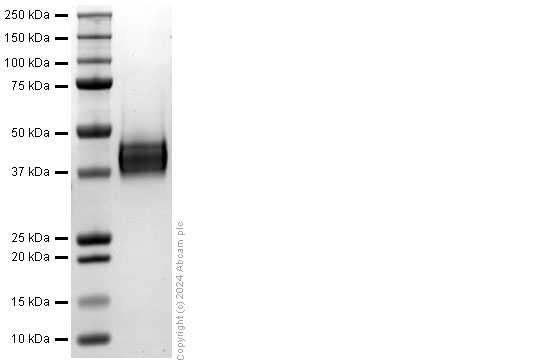 SDS-PAGE - Recombinant Human IL-12 p40 protein (His-tag) (AB322315), expandable thumbnail