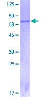 SDS-PAGE - Recombinant Human IL-12RB1 protein (AB152476), expandable thumbnail