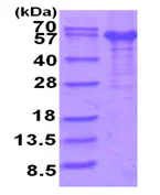 SDS-PAGE - Recombinant Human IL-12RB1 protein (denatured) (AB202232)