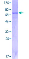 SDS-PAGE - Recombinant Human IL-12RB1 protein (GST tag N-Terminus) (AB152476)