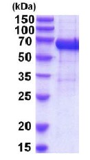 SDS-PAGE - Recombinant Human IL-12RB1 protein (His tag) (AB201886), expandable thumbnail