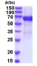 SDS-PAGE - Recombinant Human IL-12RB1 protein (His tag) (AB201886)