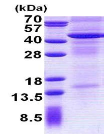 SDS-PAGE - Recombinant Human IL-13 receptor alpha 2 protein (denatured) (His tag N-Terminus) (AB156730)