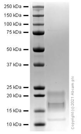 SDS-PAGE - Recombinant human IL-15 protein (Active) (AB259403), expandable thumbnail