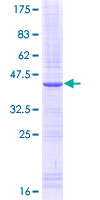 SDS-PAGE - Recombinant Human IL-15RA protein (AB114831), expandable thumbnail