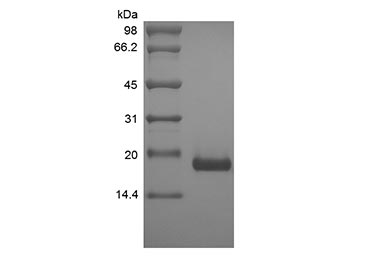 Recombinant human IL-17B protein (Active)