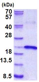 SDS-PAGE - Recombinant Human IL-17B protein (denatured) (AB156733), expandable thumbnail