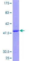 SDS-PAGE - Recombinant Human IL-17C protein (AB162110)