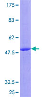 SDS-PAGE - Recombinant Human IL-17C protein (GST tag N-Terminus) (AB162110)