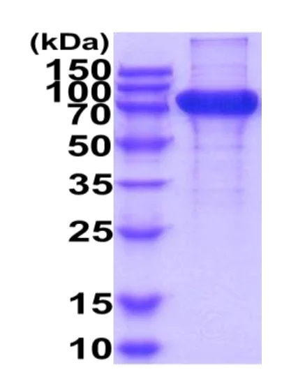 SDS-PAGE - Recombinant Human IL-17RA protein (His tag) (AB222973)