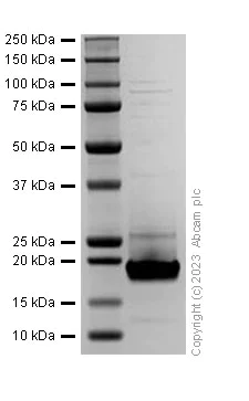 SDS-PAGE - Recombinant Human IL-18 Protein (His tag) (Active) (AB310799)