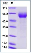 SDS-PAGE - Recombinant Human IL-18BP protein (Fc Chimera) (AB276260)