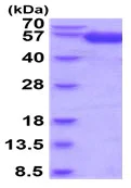 SDS-PAGE - Recombinant Human IL-18BP protein (Fc Chimera His Tag) (AB222958)