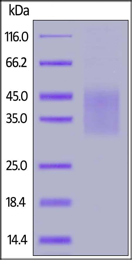 SDS-PAGE - Recombinant Human IL-18BP protein (His tag) (AB221201), expandable thumbnail