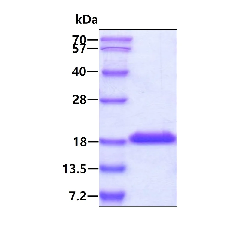 SDS-PAGE - Recombinant Human IL-1F10 protein (Tag Free) (AB203724)