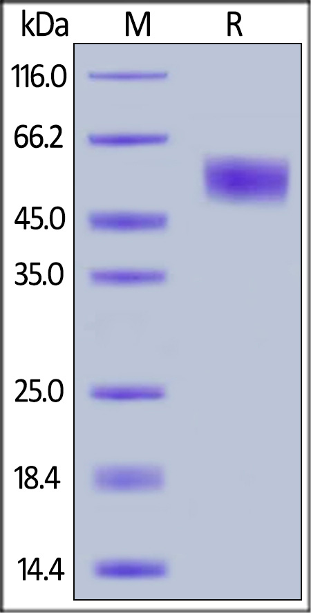 Recombinant human IL-1R-2 protein