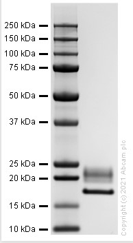 SDS-PAGE - Recombinant human IL-1RA protein (Active) (AB283447), expandable thumbnail