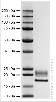 SDS-PAGE - Recombinant human IL-1RA protein (Active) (AB283447)