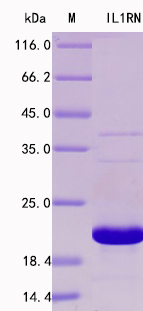 Recombinant Human IL-1ra Protein Standard (His tag)