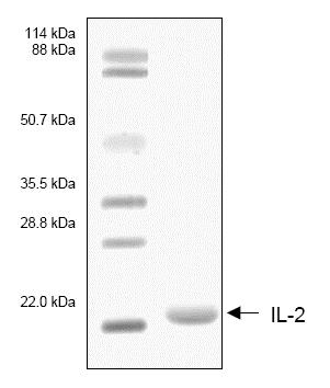 SDS-PAGE - Recombinant Human IL-2 protein (AB53322)
