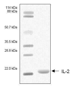 SDS-PAGE - Recombinant Human IL-2 protein (AB53322)