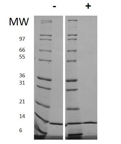 Recombinant human IL-2 protein (Active)