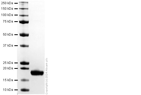 SDS-PAGE - Recombinant Human IL-2 Protein (His-tag) (AB317876), expandable thumbnail