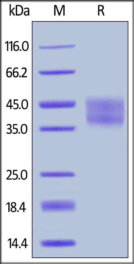 SDS-PAGE - Recombinant human IL-21R protein (AB184891), expandable thumbnail