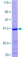SDS-PAGE - Recombinant Human IL-26 protein (AB163231), expandable thumbnail