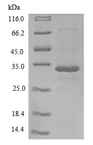 SDS-PAGE - Recombinant Human IL-26 protein (Tagged) (AB239573)