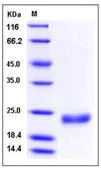 SDS-PAGE - Recombinant human IL-28B protein (His tag) (AB276441)