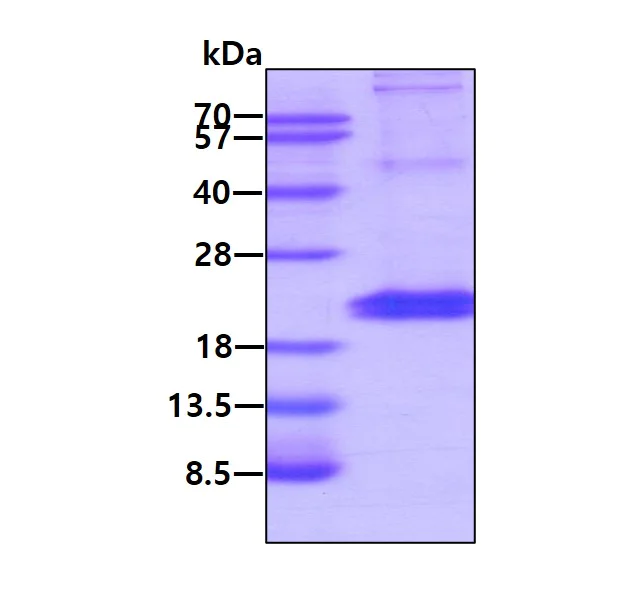 SDS-PAGE - Recombinant Human IL-28B protein (His tag C-Terminus) (AB201872)