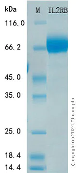 SDS-PAGE - Recombinant Human IL-2RB Protein Standard (His tag) (AB316490)