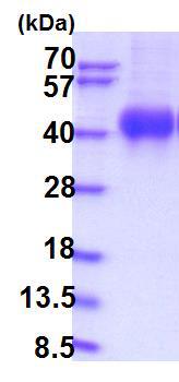 SDS-PAGE - Recombinant Human IL-2RG protein (AB201712), expandable thumbnail