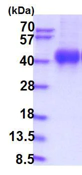 SDS-PAGE - Recombinant Human IL-2RG protein (AB201712)