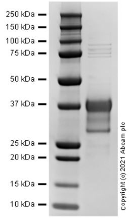 Recombinant Human IL-34 protein (Active)