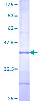 SDS-PAGE - Recombinant Human IL-36R protein (GST tag N-Terminus) (AB160204)