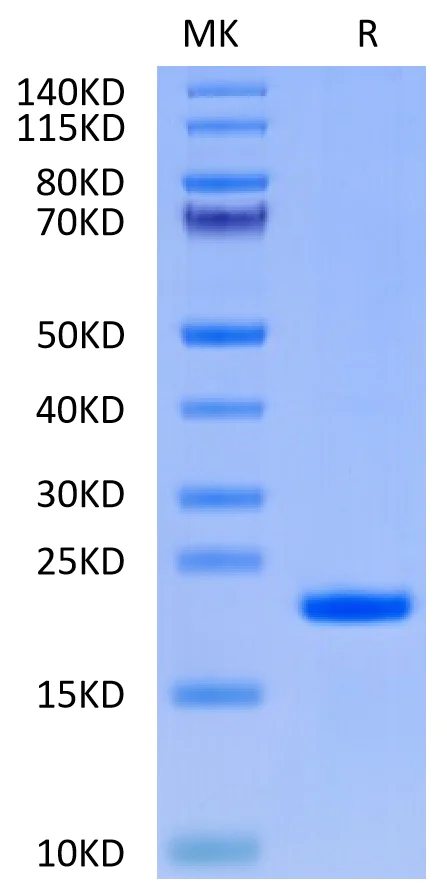 SDS-PAGE - Recombinant Human IL-37 (Active) protein (AB316043)