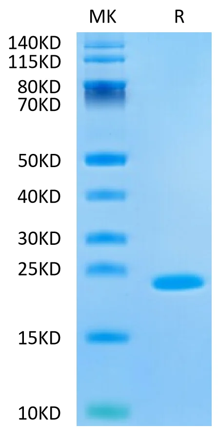 SDS-PAGE - Recombinant Human IL-37b protein (AB316042)