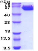 SDS-PAGE - Recombinant Human IL-3RB protein (His tag) (AB211309)