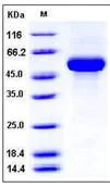 SDS-PAGE - Recombinant human IL-3RB protein (His tag) (AB276287)