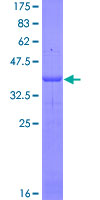 SDS-PAGE - Recombinant Human IL-4 Receptor alpha protein (AB158758)